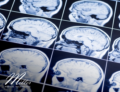 Images of a brain scan